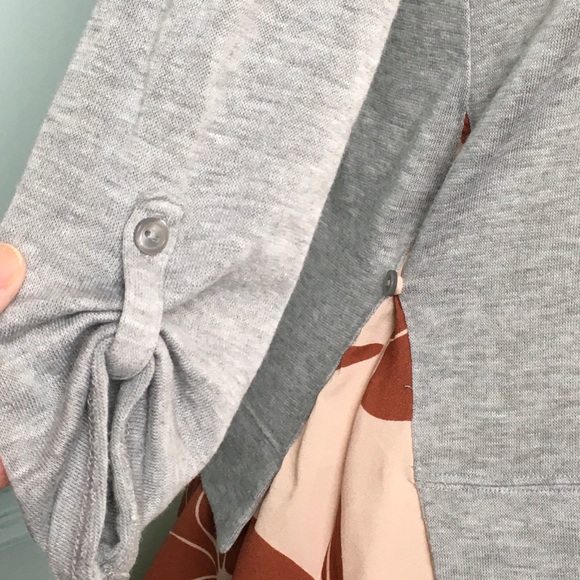 Little Yellow Button for Anthro Peplum Tunic XS - Picture 4 of 13